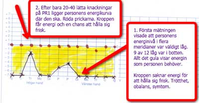 Akupunktur-energi-TFT-PR1